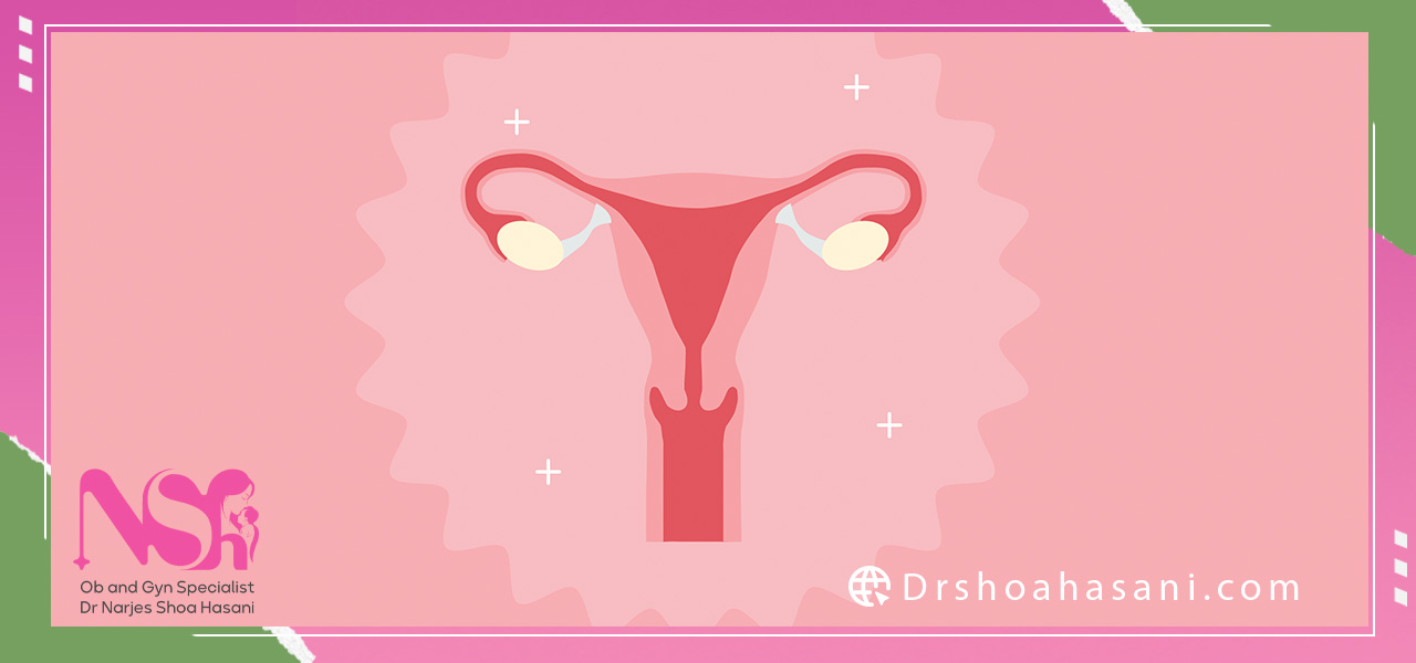 آی یو آی برای چه کسانی مناسب است؟