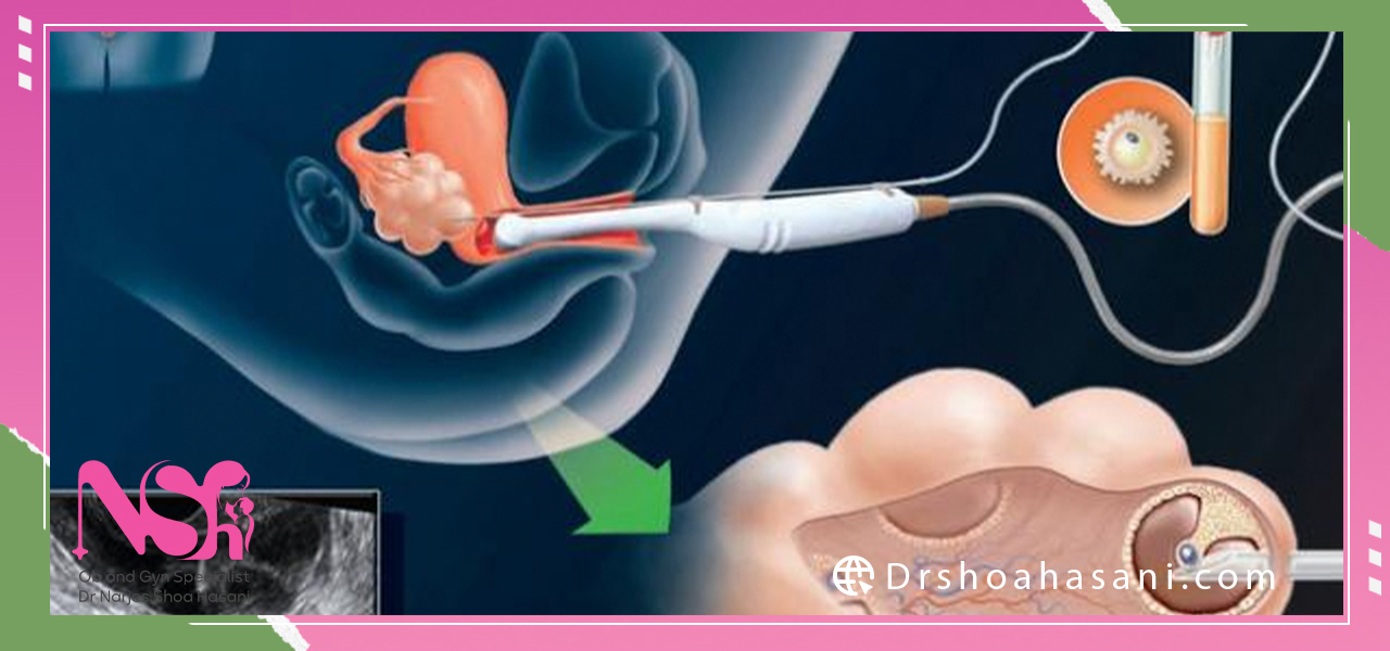 هزینه های پرداختی بابت ای یو ای