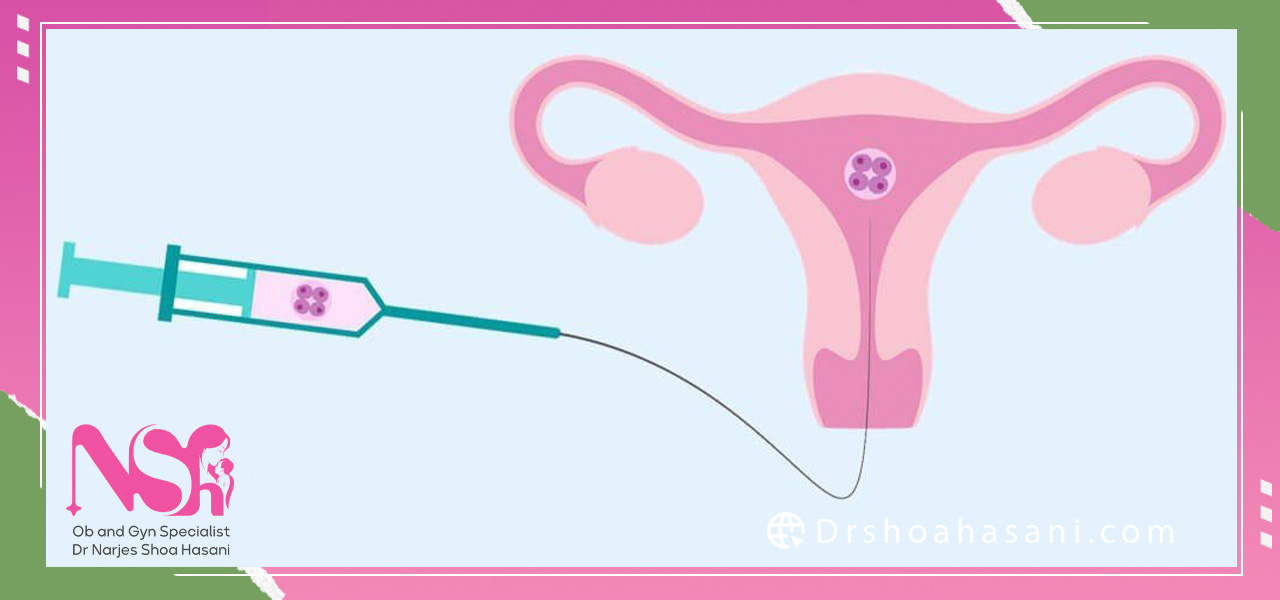 تغذیه مناسب بعد از انجام آی یو آی