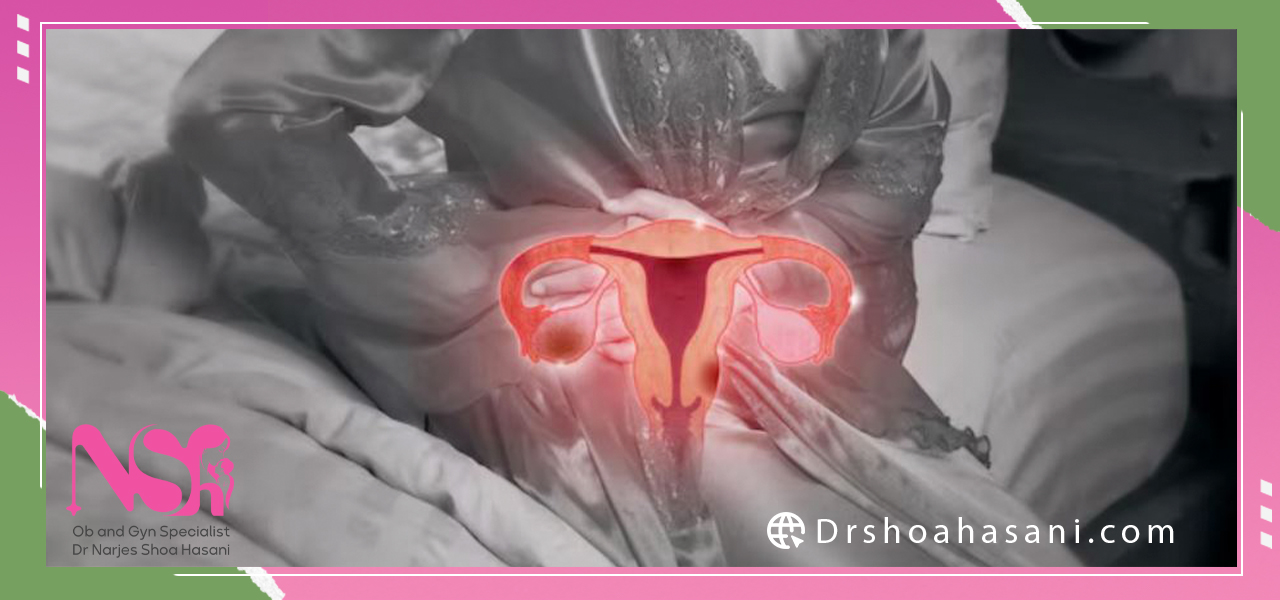 درمان افتادگی رحم