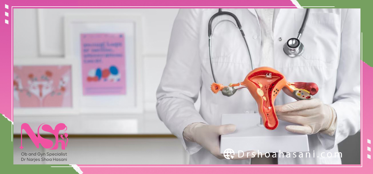 علت تنبلی تخمدان چیست؟