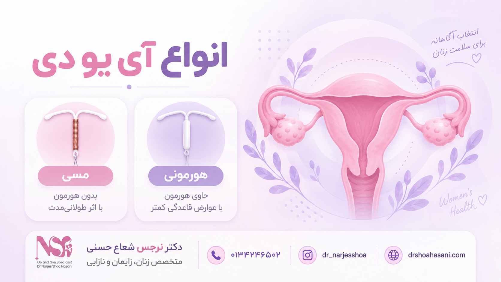 انواع آی یو دی