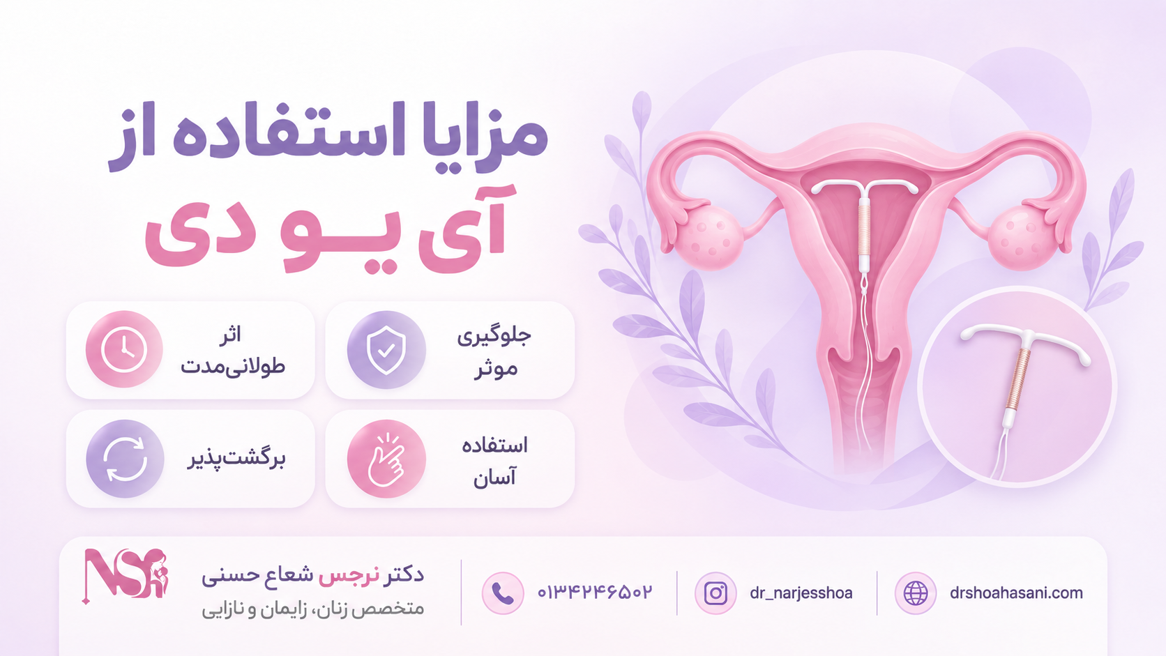 مزایا استفاده از آی یو دی